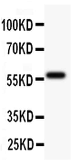 Invitrogen TdT Polyclonal Antibody 100 &mu;g; Unconjugated:Antibodies,