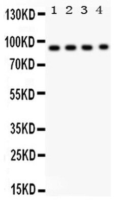 Invitrogen CD26 Polyclonal Antibody 100 &mu;g | Buy Online | Invitrogen&trade; | Fisher Scientific