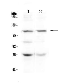 Invitrogen DPYD Polyclonal Antibody 100 &mu;g | Buy Online | Invitrogen&trade; | Fisher Scientific