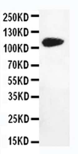 Invitrogen DPYD Polyclonal Antibody 100 &mu;g; Unconjugated:Antibodies,