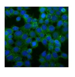 Desmoglein 2 (DSG2) Polyclonal Antibody:Antibodies, Polyclonal
