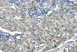 Desmoglein 2 (DSG2) Polyclonal Antibody:Antibodies, Polyclonal