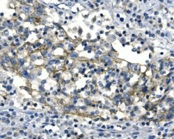 Desmoglein 2 (DSG2) Polyclonal Antibody:Antibodies, Polyclonal
