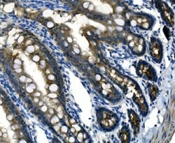 Desmoglein 2 (DSG2) Polyclonal Antibody:Antibodies, Polyclonal