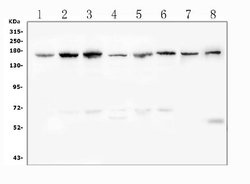 Desmoglein 2 (DSG2) Polyclonal Antibody:Antibodies, Polyclonal