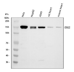 Desmoglein 2 (DSG2) Polyclonal Antibody:Antibodies, Polyclonal