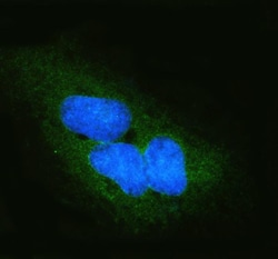 Invitrogen DYNLT1 Polyclonal Antibody 100 &mu;g; Unconjugated:Antibodies,