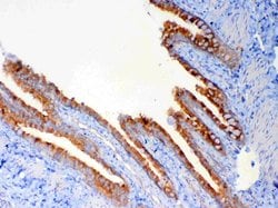 Invitrogen DYNLT1 Polyclonal Antibody 100 &mu;g; Unconjugated:Antibodies,