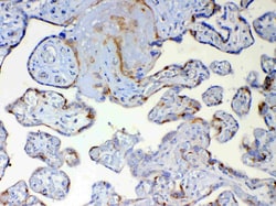 Invitrogen DYNLT1 Polyclonal Antibody 100 &mu;g; Unconjugated:Antibodies,
