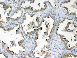 Invitrogen DYNLT1 Polyclonal Antibody 100 &mu;g; Unconjugated:Antibodies,
