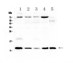 Invitrogen DYNLT1 Polyclonal Antibody 100 &mu;g; Unconjugated:Antibodies,