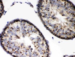 Invitrogen EBAG9 Polyclonal Antibody 100 &mu;g; Unconjugated:Antibodies,