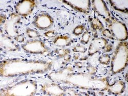 Invitrogen EBAG9 Polyclonal Antibody 100 &mu;g; Unconjugated:Antibodies,