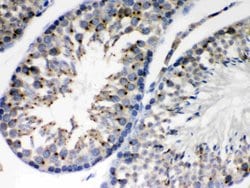 Invitrogen EBAG9 Polyclonal Antibody 100 &mu;g; Unconjugated:Antibodies,