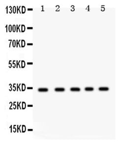 Invitrogen EBAG9 Polyclonal Antibody 100 &mu;g; Unconjugated:Antibodies,