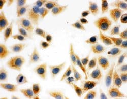 DCI Polyclonal Antibody:Antibodies, Polyclonal