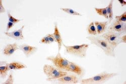 DCI Polyclonal Antibody:Antibodies, Polyclonal