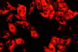 DCI Polyclonal Antibody:Antibodies, Polyclonal