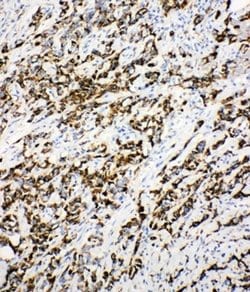DCI Polyclonal Antibody:Antibodies, Polyclonal
