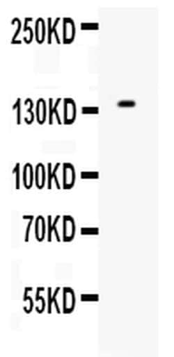 Invitrogen EGF Polyclonal Antibody 100 &mu;g; Unconjugated:Antibodies,