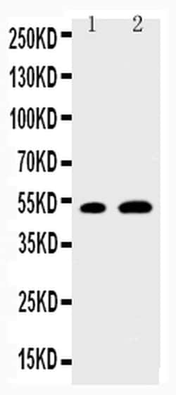 Invitrogen EGR2 Polyclonal Antibody 100 &mu;g; Unconjugated:Antibodies,