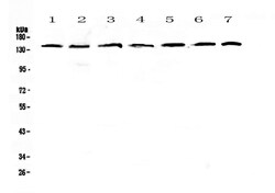 Invitrogen PERK Polyclonal Antibody 100 &mu;g; Unconjugated:Antibodies,