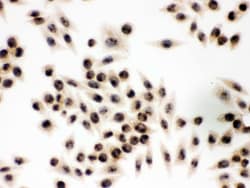 Invitrogen eIF6 Polyclonal Antibody 100 &mu;g; Unconjugated:Antibodies,