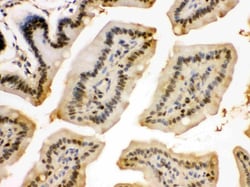 Invitrogen eIF6 Polyclonal Antibody 100 &mu;g; Unconjugated:Antibodies,