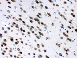 Invitrogen HuD Polyclonal Antibody 100 &mu;g; Unconjugated:Antibodies,