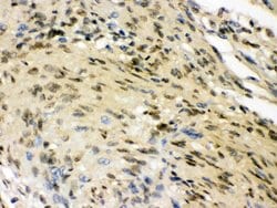 Invitrogen HuD Polyclonal Antibody 100 &mu;g; Unconjugated:Antibodies,