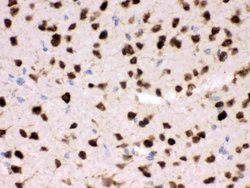 Invitrogen HuD Polyclonal Antibody 100 &mu;g; Unconjugated:Antibodies,