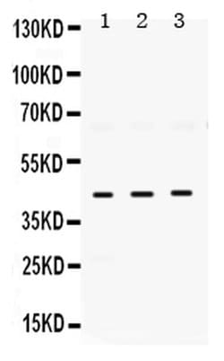 Invitrogen HuD Polyclonal Antibody 100 &mu;g; Unconjugated:Antibodies,