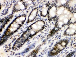 Invitrogen EME1 Polyclonal Antibody 100 &mu;g; Unconjugated:Antibodies,