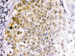 Invitrogen EME1 Polyclonal Antibody 100 &mu;g; Unconjugated:Antibodies,