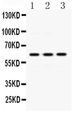 Invitrogen EME1 Polyclonal Antibody 100 &mu;g; Unconjugated:Antibodies,