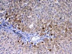 Invitrogen CD105 (Endoglin) Polyclonal Antibody 100 &mu;g; Unconjugated:Antibodies,