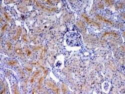 Invitrogen CD105 (Endoglin) Polyclonal Antibody 100 &mu;g; Unconjugated:Antibodies,