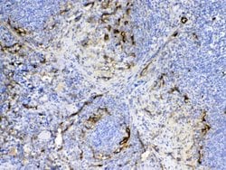 Invitrogen CD105 (Endoglin) Polyclonal Antibody 100 &mu;g; Unconjugated:Antibodies,