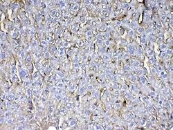 Invitrogen CD105 (Endoglin) Polyclonal Antibody 100 &mu;g; Unconjugated:Antibodies,