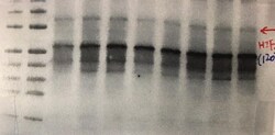 Invitrogen HIF-2 alpha Polyclonal Antibody 100 &mu;g; Unconjugated:Antibodies,