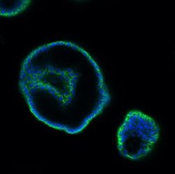 EpCAM (CD326) Polyclonal Antibody:Antibodies, Polyclonal