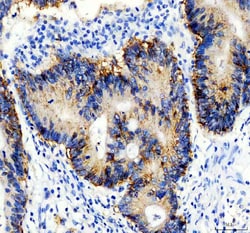 EpCAM (CD326) Polyclonal Antibody:Antibodies, Polyclonal