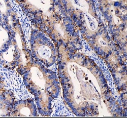 EpCAM (CD326) Polyclonal Antibody:Antibodies, Polyclonal