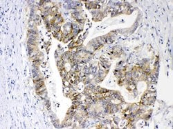 EpCAM (CD326) Polyclonal Antibody:Antibodies, Polyclonal