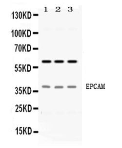 EpCAM (CD326) Polyclonal Antibody:Antibodies, Polyclonal