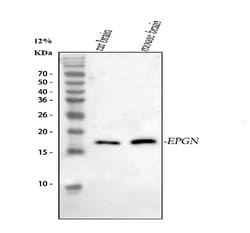 Invitrogen Epigen Polyclonal Antibody 100 &mu;g | Buy Online | Invitrogen&trade; | Fisher Scientific