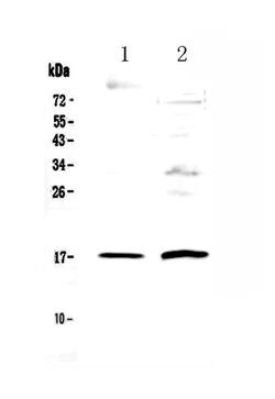 Invitrogen Epigen Polyclonal Antibody 100 &mu;g; Unconjugated:Antibodies,
