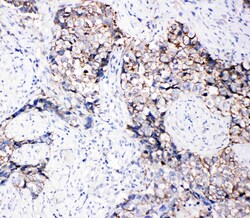 Invitrogen EphB3 Polyclonal Antibody 100 &mu;g; Unconjugated:Antibodies,