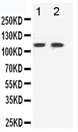 Invitrogen EphB3 Polyclonal Antibody 100 &mu;g; Unconjugated:Antibodies,