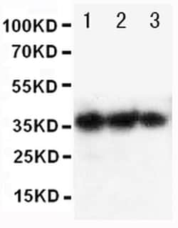 Invitrogen Epo Polyclonal Antibody 100 &mu;g | Buy Online | Invitrogen&trade; | Fisher Scientific